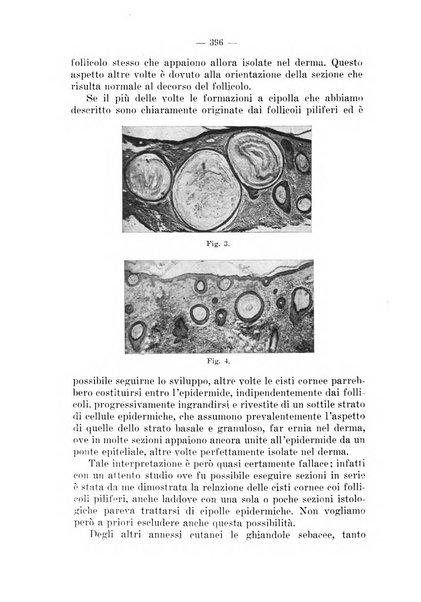 Il dermosifilografo gazzetta di dermosifilografia per il medico pratico