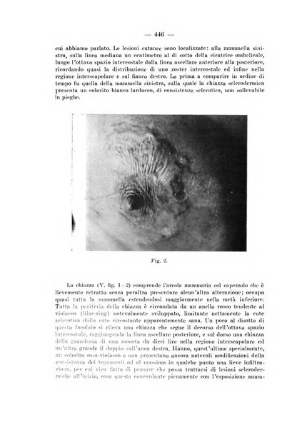 Il dermosifilografo gazzetta di dermosifilografia per il medico pratico