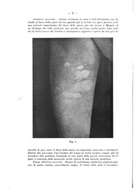 Il dermosifilografo gazzetta di dermosifilografia per il medico pratico