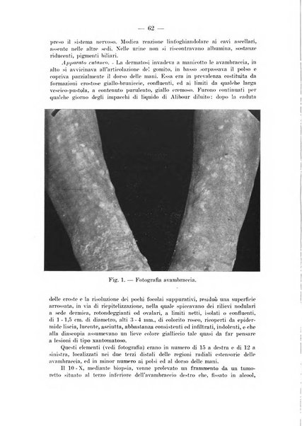 Il dermosifilografo gazzetta di dermosifilografia per il medico pratico