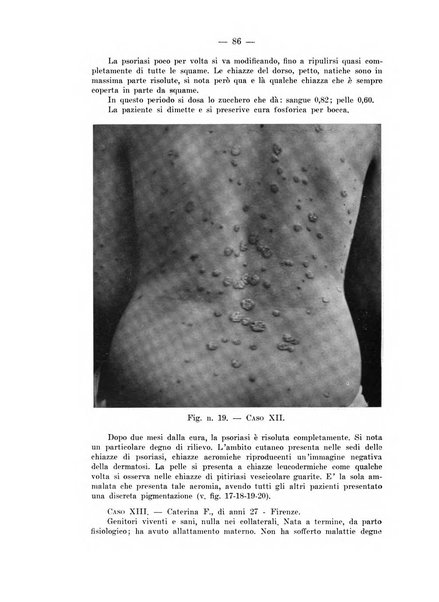 Il dermosifilografo gazzetta di dermosifilografia per il medico pratico