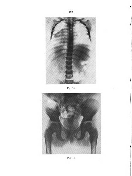 Il dermosifilografo gazzetta di dermosifilografia per il medico pratico