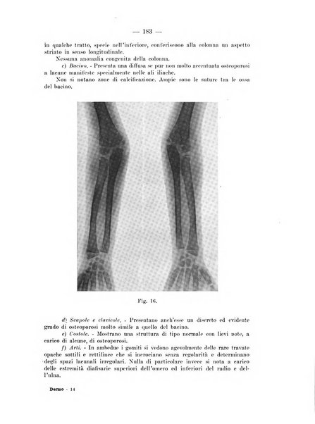 Il dermosifilografo gazzetta di dermosifilografia per il medico pratico