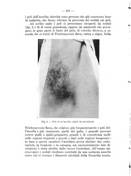 Il dermosifilografo gazzetta di dermosifilografia per il medico pratico