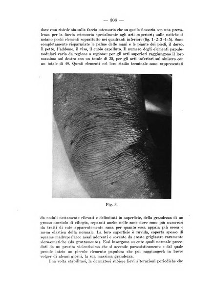 Il dermosifilografo gazzetta di dermosifilografia per il medico pratico