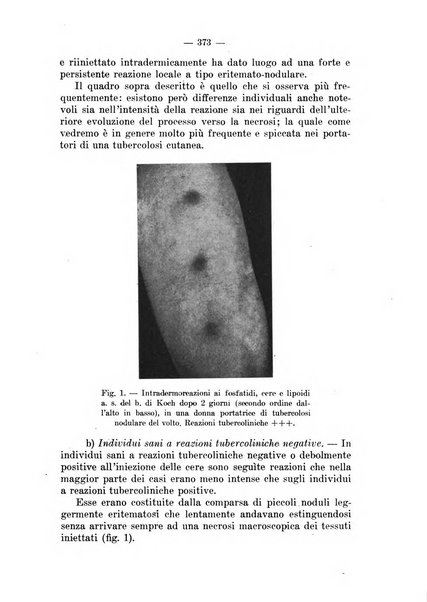 Il dermosifilografo gazzetta di dermosifilografia per il medico pratico