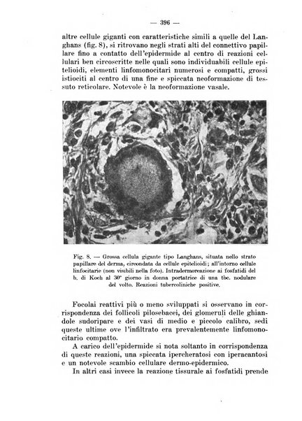 Il dermosifilografo gazzetta di dermosifilografia per il medico pratico