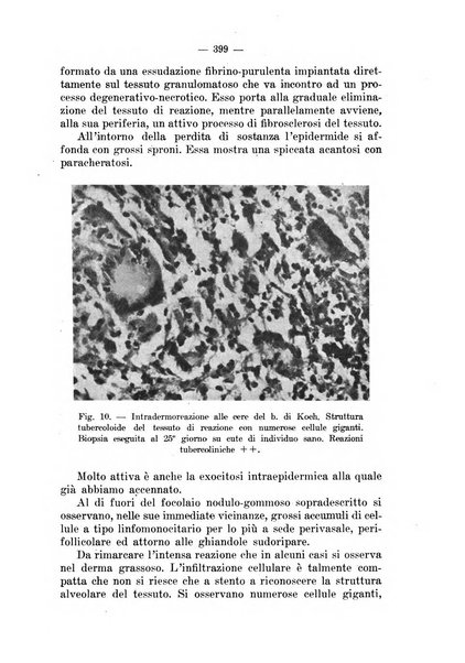 Il dermosifilografo gazzetta di dermosifilografia per il medico pratico