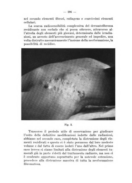 Il dermosifilografo gazzetta di dermosifilografia per il medico pratico