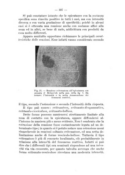 Il dermosifilografo gazzetta di dermosifilografia per il medico pratico