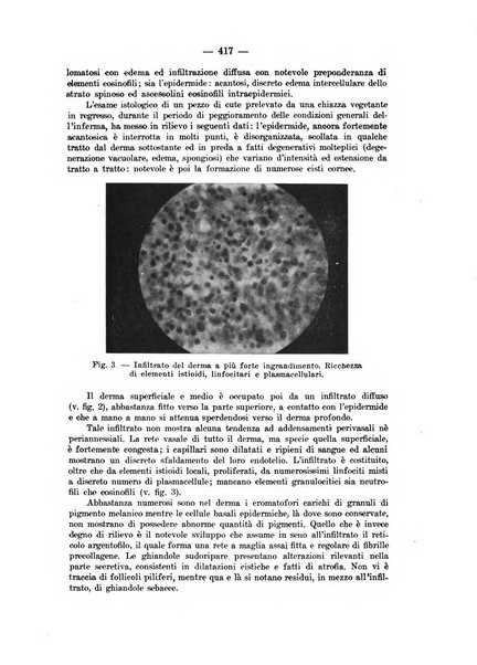 Il dermosifilografo gazzetta di dermosifilografia per il medico pratico