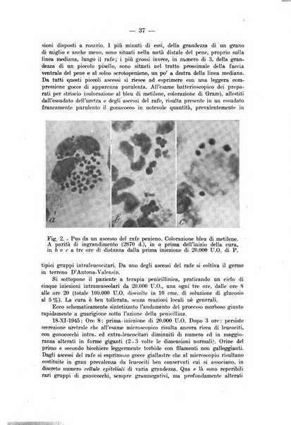 Il dermosifilografo gazzetta di dermosifilografia per il medico pratico