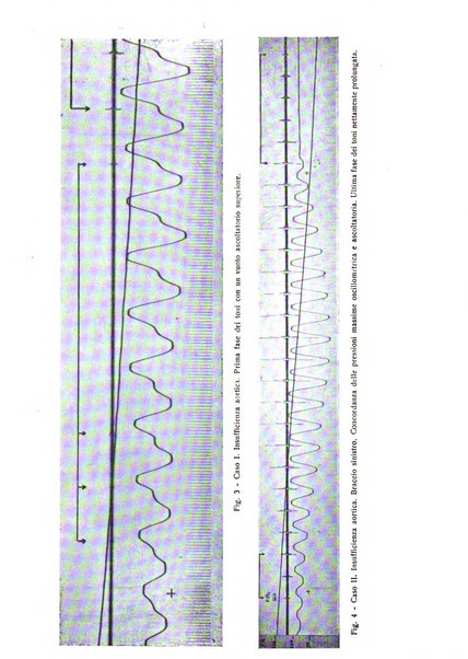 Folia cardiologica