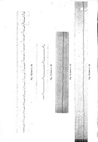 Folia cardiologica