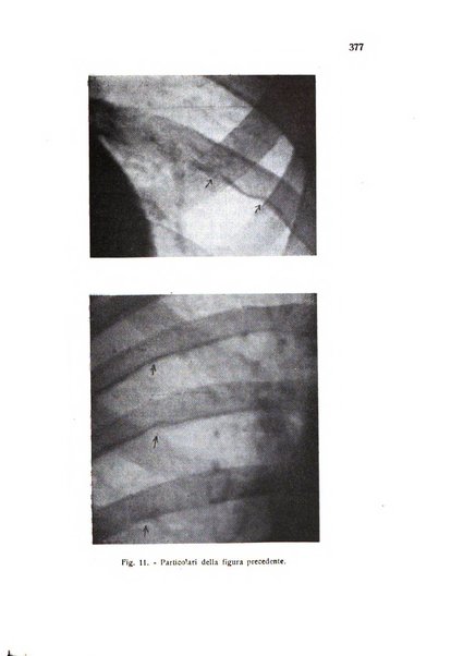 Folia cardiologica