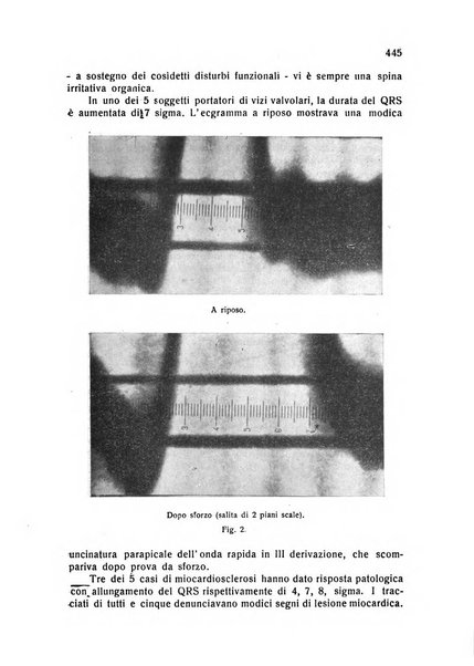 Folia cardiologica