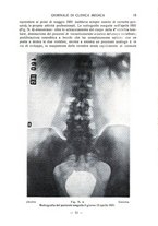 giornale/TO00185155/1932/v.13/00000021