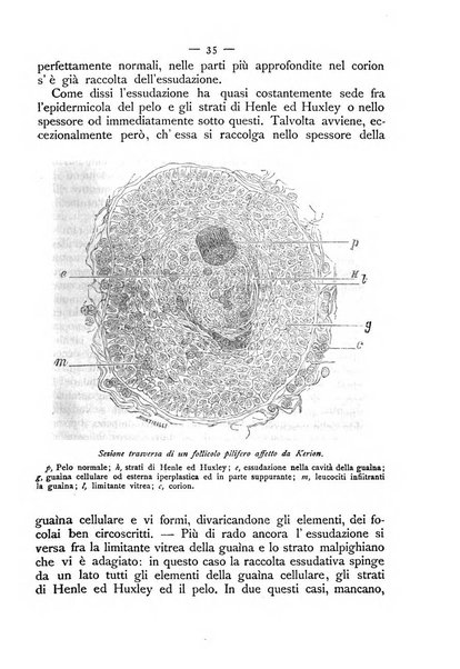 Giornale italiano delle malattie veneree e della pelle