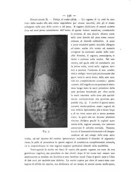 Giornale italiano delle malattie veneree e della pelle