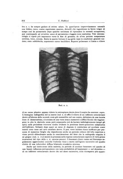 Lotta contro la tubercolosi rivista mensile