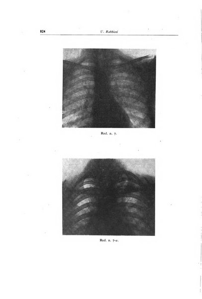 Lotta contro la tubercolosi rivista mensile