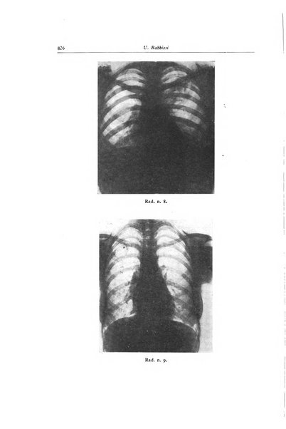 Lotta contro la tubercolosi rivista mensile