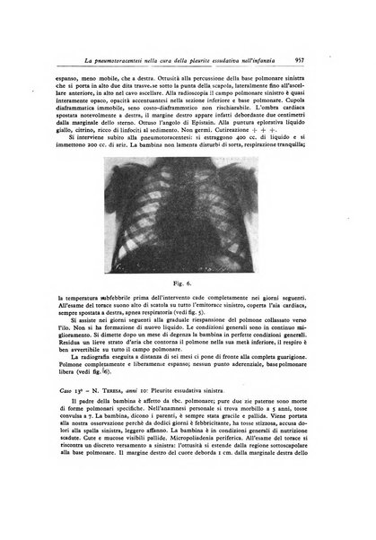 Lotta contro la tubercolosi rivista mensile