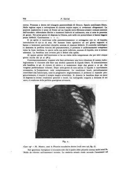 Lotta contro la tubercolosi rivista mensile