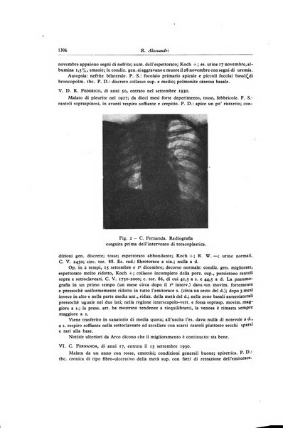 Lotta contro la tubercolosi rivista mensile