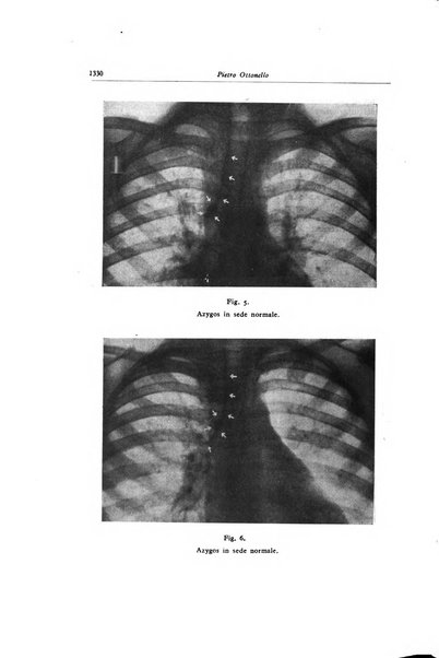 Lotta contro la tubercolosi rivista mensile