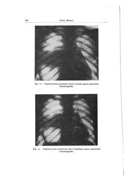 Lotta contro la tubercolosi rivista mensile