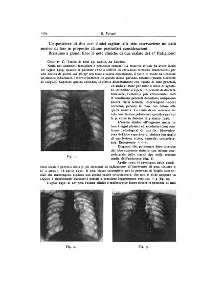 Lotta contro la tubercolosi rivista mensile