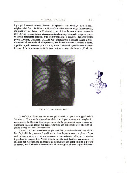 Lotta contro la tubercolosi rivista mensile