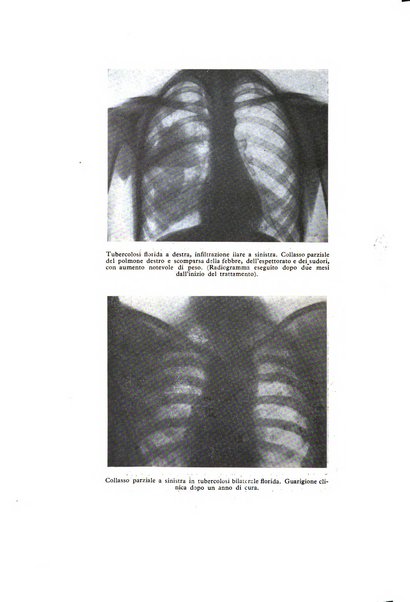 Lotta contro la tubercolosi rivista mensile