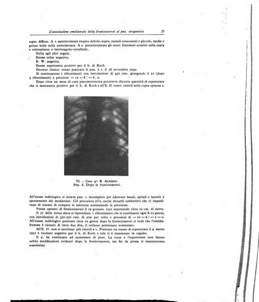 Lotta contro la tubercolosi rivista mensile