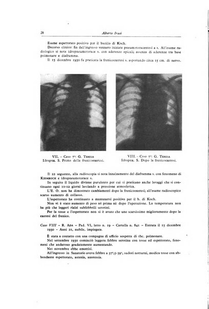 Lotta contro la tubercolosi rivista mensile