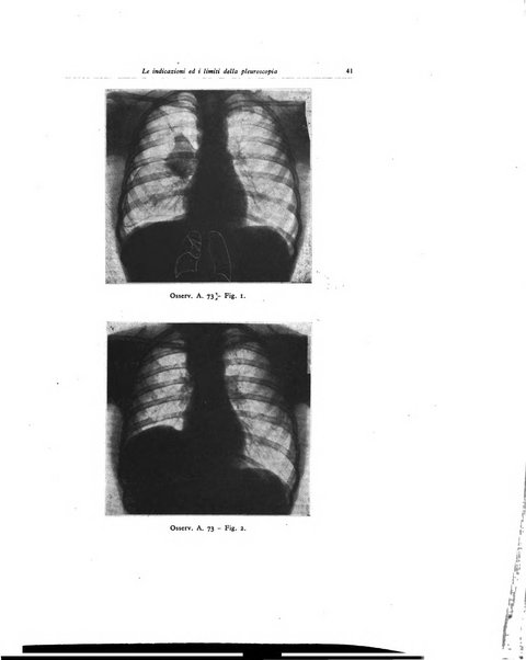 Lotta contro la tubercolosi rivista mensile