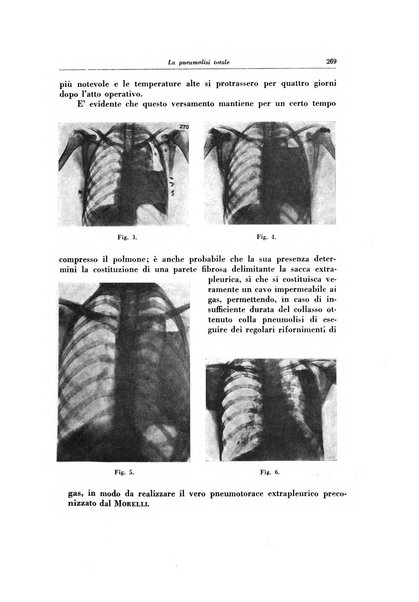 Lotta contro la tubercolosi rivista mensile