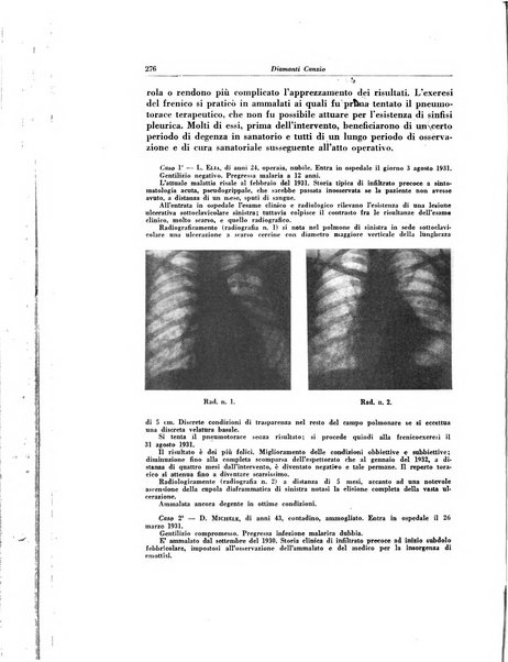 Lotta contro la tubercolosi rivista mensile