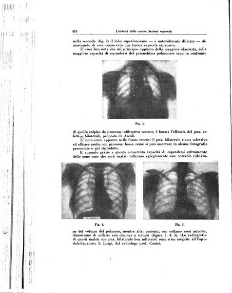 Lotta contro la tubercolosi rivista mensile