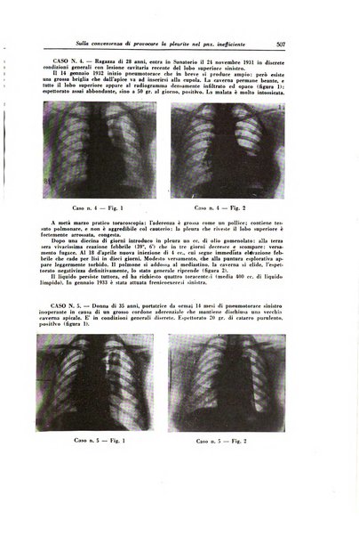 Lotta contro la tubercolosi rivista mensile