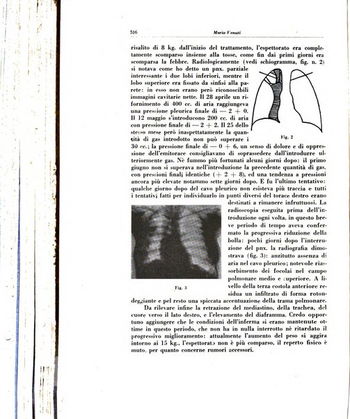 Lotta contro la tubercolosi rivista mensile