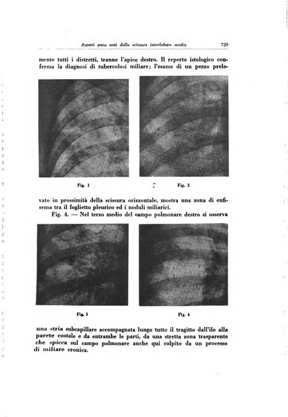 Lotta contro la tubercolosi rivista mensile