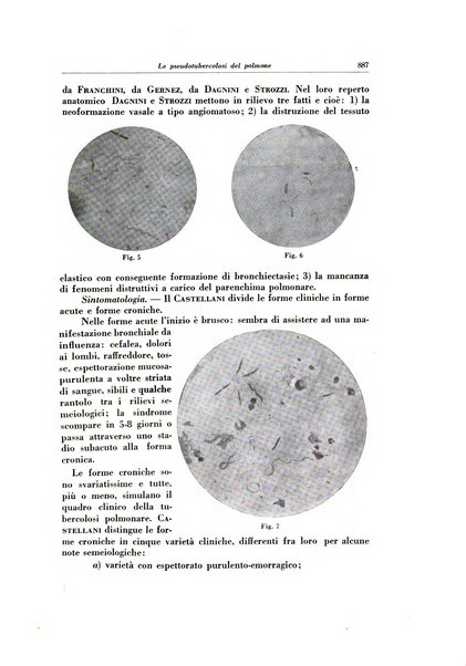 Lotta contro la tubercolosi rivista mensile