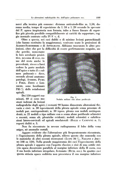 Lotta contro la tubercolosi rivista mensile