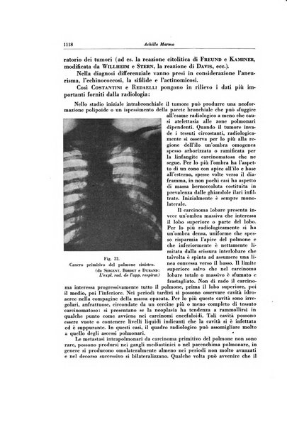 Lotta contro la tubercolosi rivista mensile