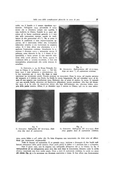 Lotta contro la tubercolosi rivista mensile