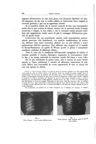 Lotta contro la tubercolosi rivista mensile