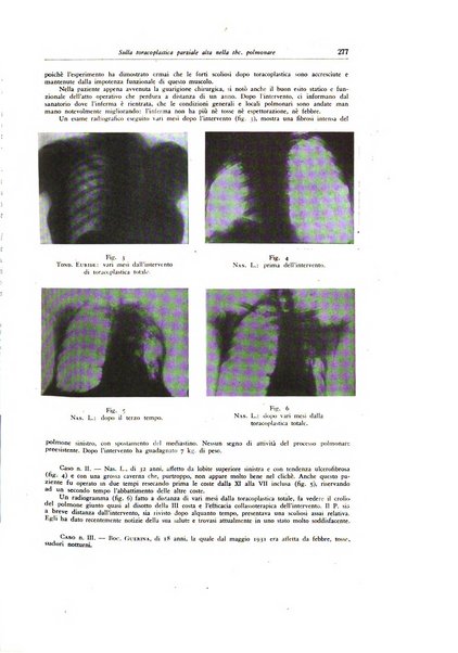 Lotta contro la tubercolosi rivista mensile