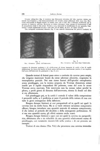 Lotta contro la tubercolosi rivista mensile